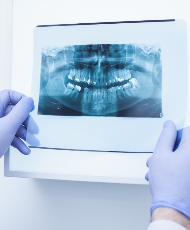 Dentist holding a screen showing x rays of teeth